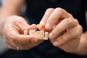 Dental Crowns Midlothian