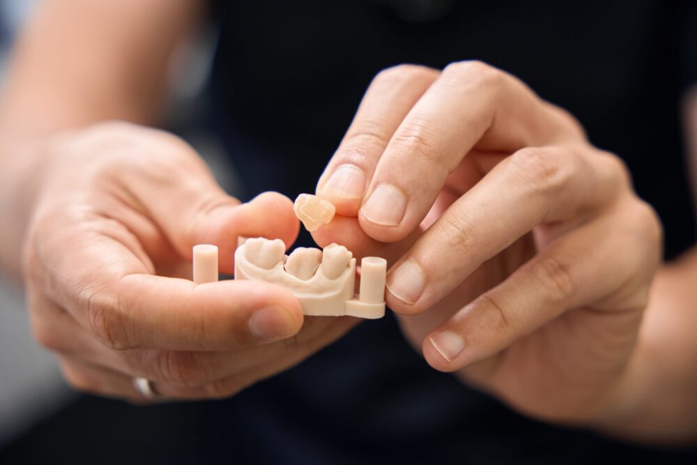 Dental Crowns Midlothian